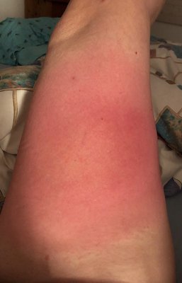 81E3FA85-9C98-4A46-94E3-3966842C454B.jpeg (624.55 KiB) 6776 mal betrachtet Oberseite